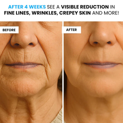 NUVEA CARE MicroNeedling set Microneedle Infusion Anti-Aging Solution