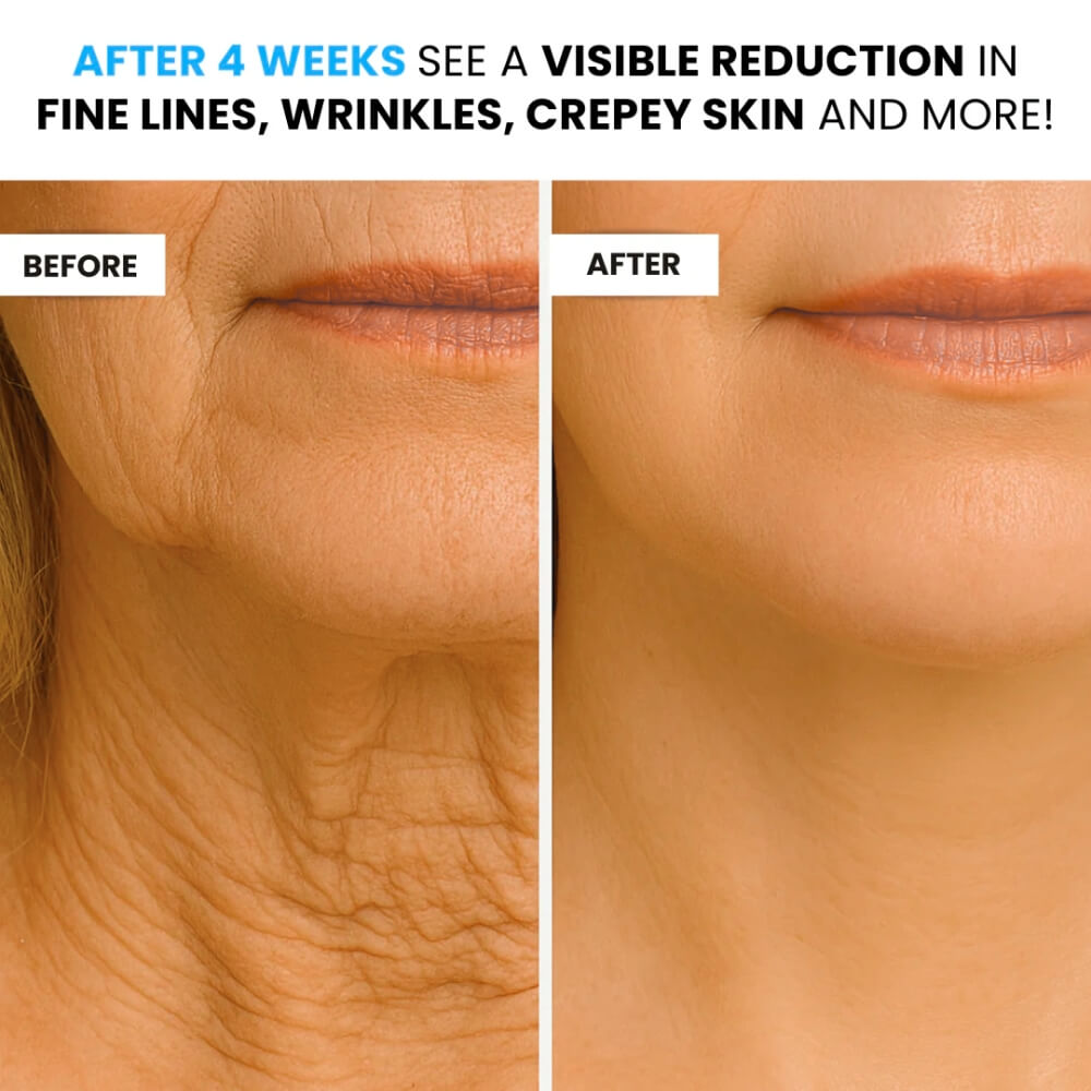 NUVEA CARE MicroNeedling set Microneedle Infusion Anti-Aging Solution