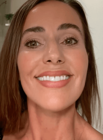 NUVEA CARE MicroNeedling set Microneedle Infusion Anti - Aging Solution - Nuvea care